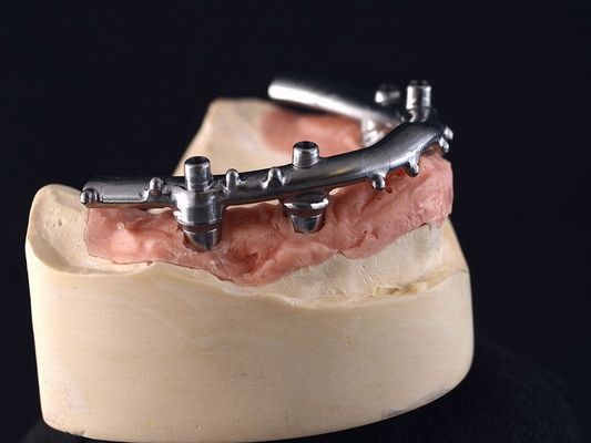 O implante do CNC do titânio All-On-4 fixou dentaduras para a clínica dental