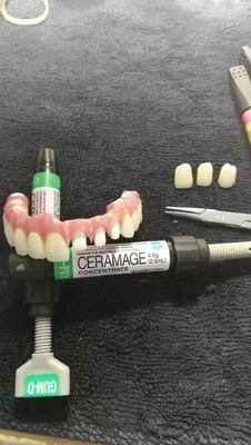 CAD-CAM Resina-baseado fixou a restauração removível da estética da ponte