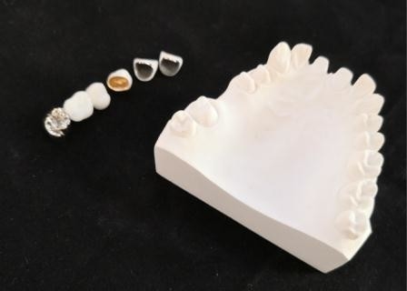 Resistência de corrosão completa personalizada do metal da coroa dental da porcelana de PFM