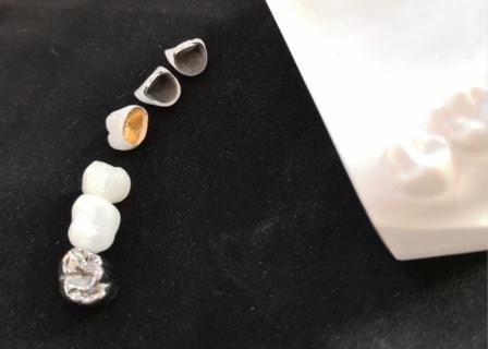 Resistência de corrosão completa personalizada do metal da coroa dental da porcelana de PFM