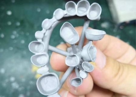 Resistência de corrosão completa personalizada do metal da coroa dental da porcelana de PFM