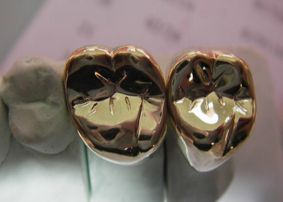 Carcaça fácil dental semi preciosa alta da ponte PFM da coroa da estabilidade