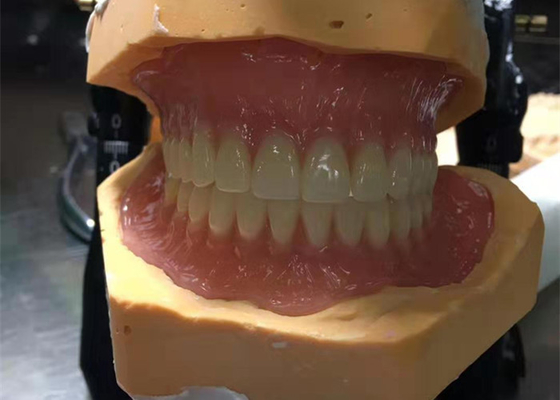 CAD-CAM que 3D de borracha imprimiu coroas são fáceis de manter e caber