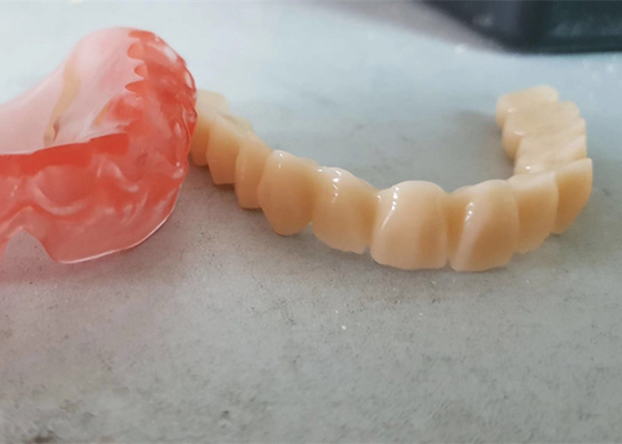 O OEM realístico 3D dos dados de Digitas imprimiu modelos dentais para o dentista Study