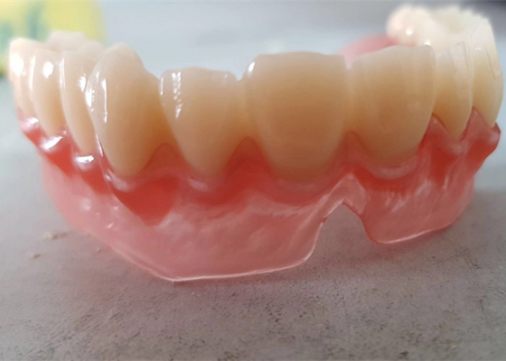 O OEM realístico 3D dos dados de Digitas imprimiu modelos dentais para o dentista Study
