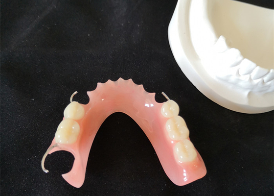Superfície lisa dental da estabilidade de cor da ponte alta da definição PFM
