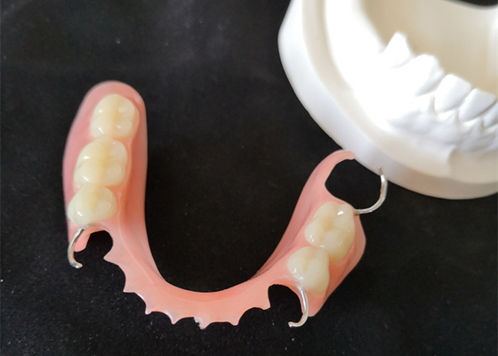 Superfície lisa dental da estabilidade de cor da ponte alta da definição PFM