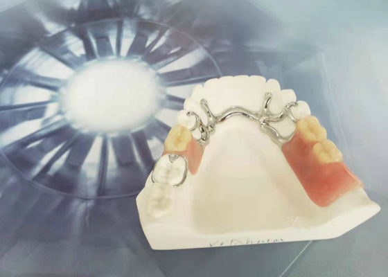 Cocr Chrome moldou a dureza forte limpa fácil da coroa dental removível