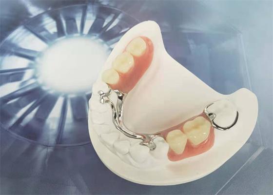 Cocr Chrome moldou a dureza forte limpa fácil da coroa dental removível