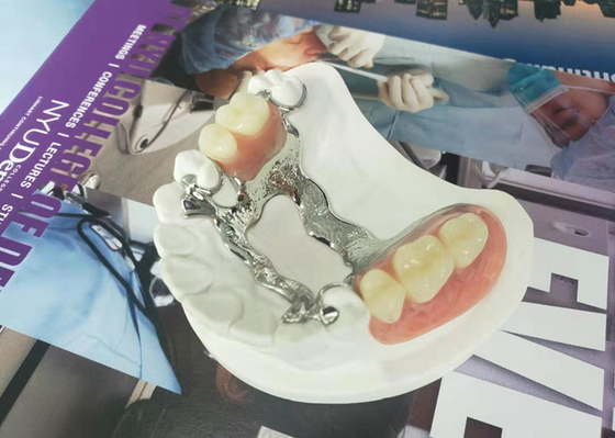 Natrural protege 3D que imprime dentadura removível fixa para o dentista Study
