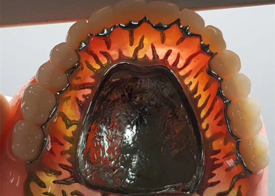 Coroa dental removível do OEM da segurança da alta intensidade para o dentista Study