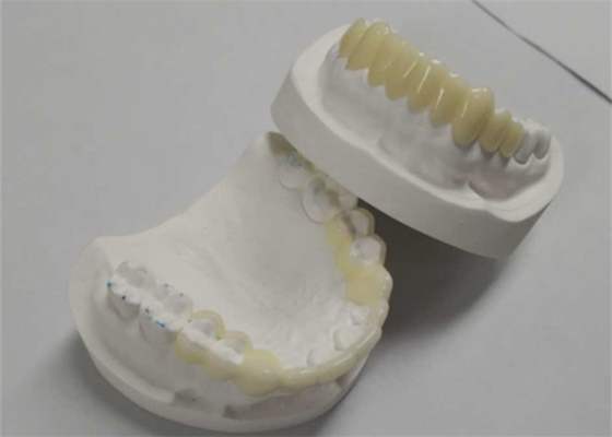 Alta durabilidade CAD CAM Impressão 3D Coroas temporárias Resina durável