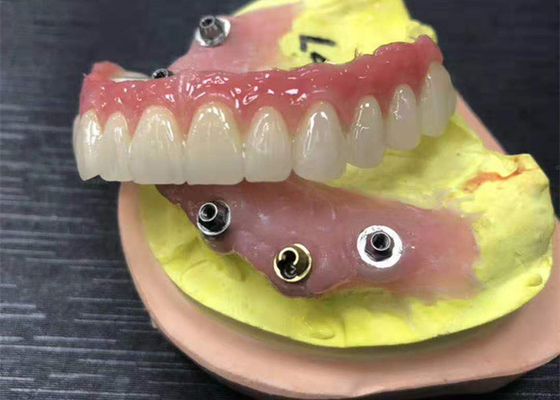 Coroa dental da zircônia do limite do implante natural toda em quatro dentaduras