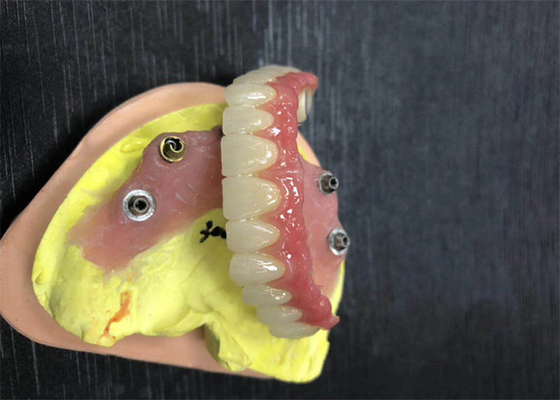 Coroa dental da zircônia do limite do implante natural toda em quatro dentaduras