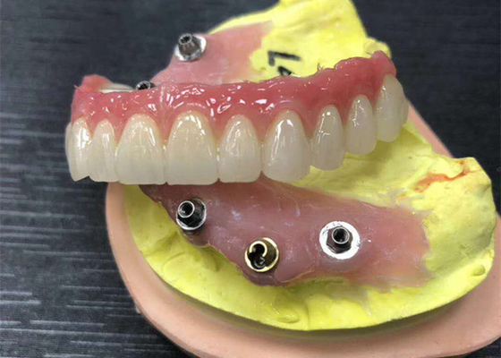 Coroa dental da zircônia do limite do implante natural toda em quatro dentaduras