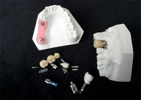 Coroa alta do implante dental da zircônia da durabilidade para a restauração dental