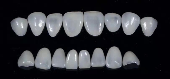 Os folheados compostos dentais de Durablity CAD-CAM detalharam altamente exato