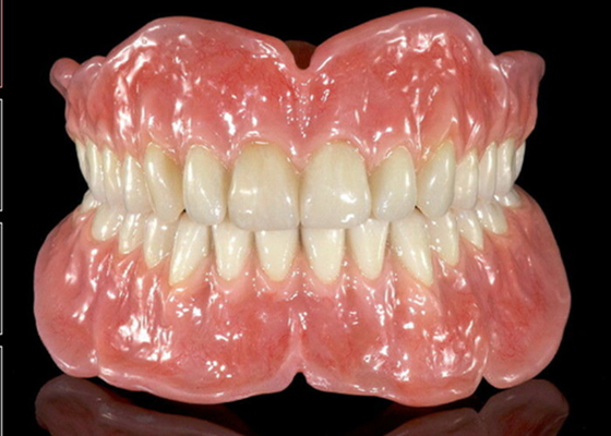 A dentadura parcial da coroa dental removível de borracha flexível fácil mantém
