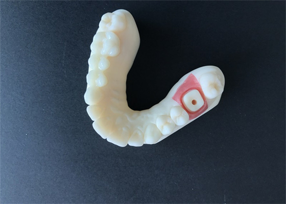 O dente alto da coroa da zircônia da estabilidade PFM mancha resistente para a pesquisa