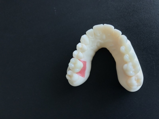 O dente alto da coroa da zircônia da estabilidade PFM mancha resistente para a pesquisa