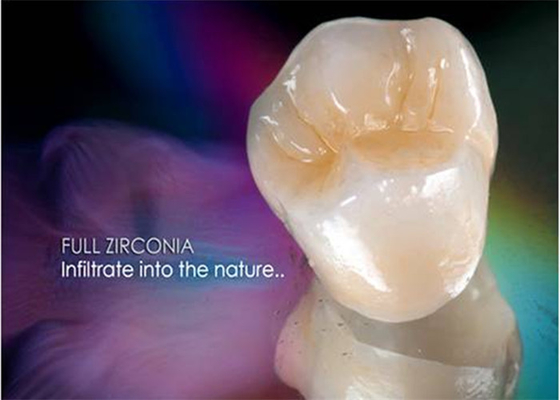 Folheie ultra duramente as dentaduras de lustro do implante da coroa Todo-cerâmica dentais