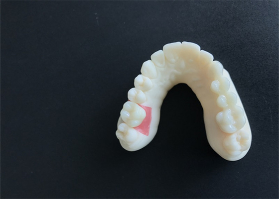 laboratório dental das dentaduras do projeto do CAD CAM do modelo de 3D Digitas