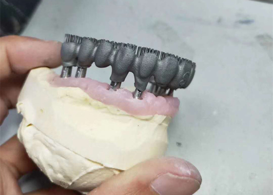 Impressora durável Dental Lab Prints do CAD CAM PFM 3D para a pesquisa