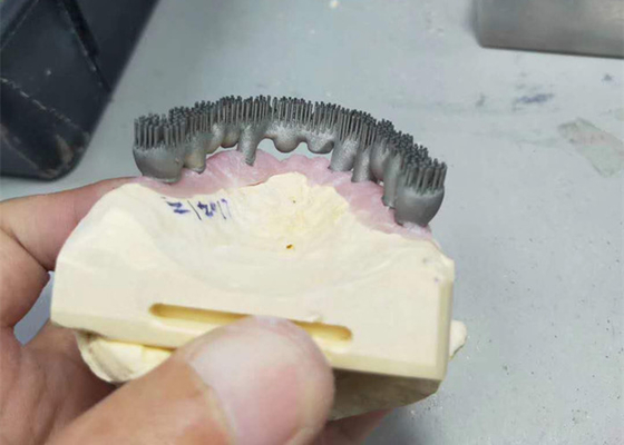 Impressora durável Dental Lab Prints do CAD CAM PFM 3D para a pesquisa