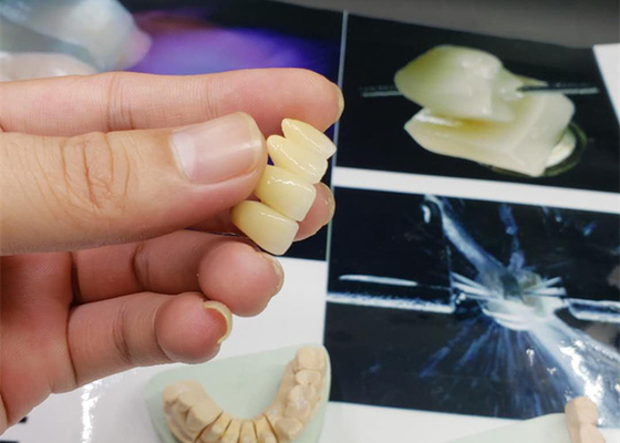 Coroa resistente à corrosão da porcelana do OEM da segurança todo o olhar natural cerâmico