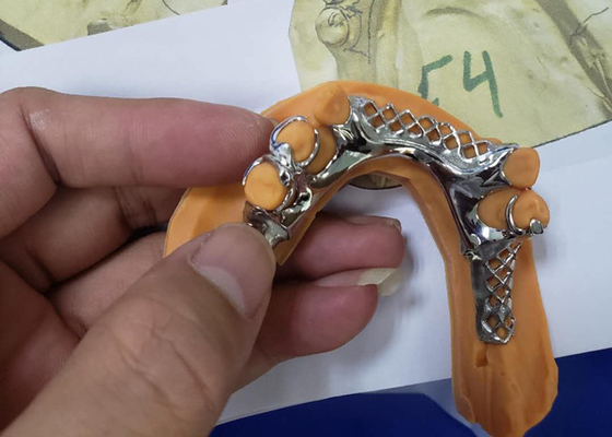 3D que imprime modelos dentais removíveis da estrutura da coroa para a odontologia