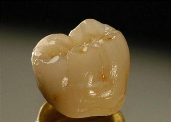 Coroa dental da porcelana inter da miscibilidade