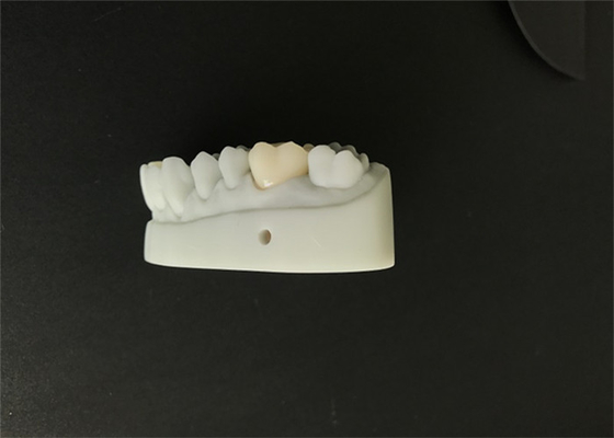 O OEM 3D imprimiu o projeto dental do CAD CAM dos modelos para o laboratório da dentadura