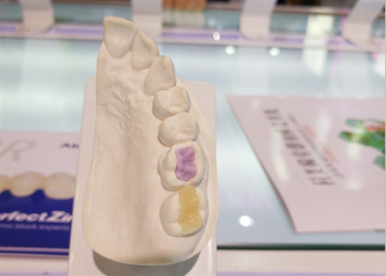 Coroa Todo-cerâmica de FDA da cerâmica dental feita sob encomenda feita sob encomenda do alto densidade