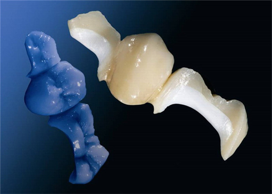 OEM personalizado que lustra o Onlay dental Todo-cerâmico do embutimento do folheado da coroa