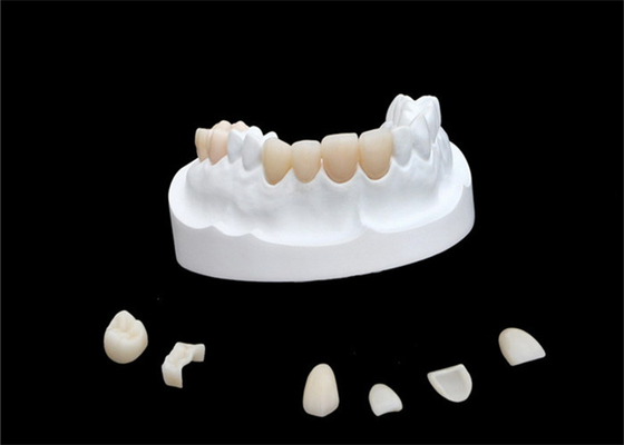 Folheados compostos da porcelana do IPS E Max Ceramic Dental Crown Comfortable