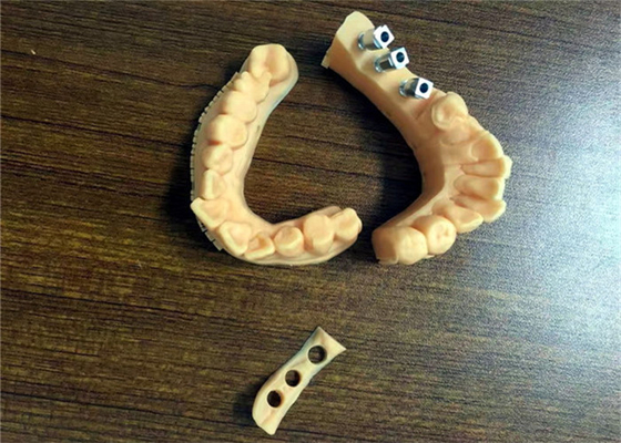 FDA 3D imprimiu a porcelana dental da coroa dos modelos dentais fundida ao metal
