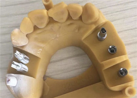 Coroa dental 3D de Digitas Biocompatibility PFM que imprime coroas provisórias
