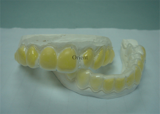 Os dispositivos ortodônticos de FDA são resistentes à corrosão e duráveis