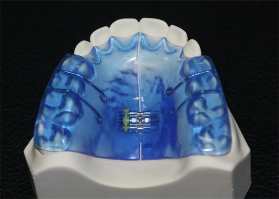 Instrumentos dentais ortopédicos com estabilidade alta e o bom Biocompatibility