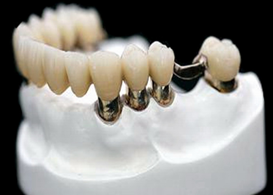 Resistência de corrosão da dentadura do acessório da precisão do CR MK1 do CO