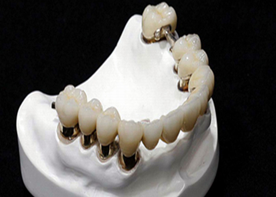 Resistência de corrosão da dentadura do acessório da precisão do CR MK1 do CO