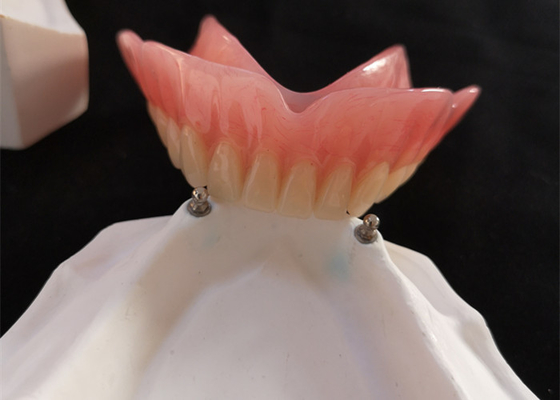 Implante alto da dentadura CAD-CAM do acessório da precisão de Biocompatibility