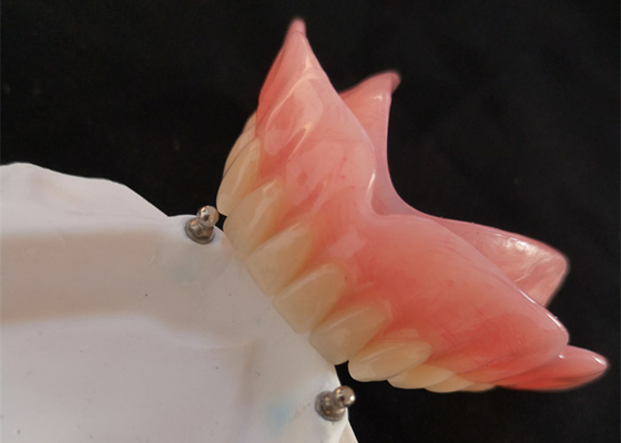 Implante alto da dentadura CAD-CAM do acessório da precisão de Biocompatibility