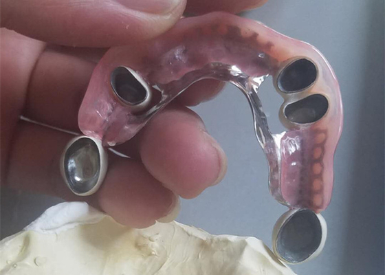Dentadura durável flexível do acessório da precisão resistente à corrosão