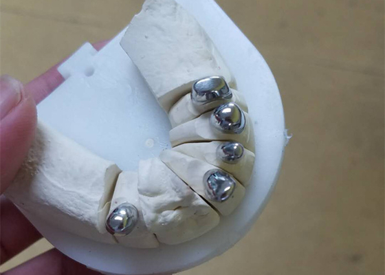 Dentadura durável flexível do acessório da precisão resistente à corrosão