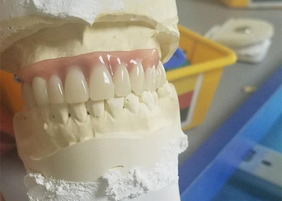 Dentadura durável flexível do acessório da precisão resistente à corrosão