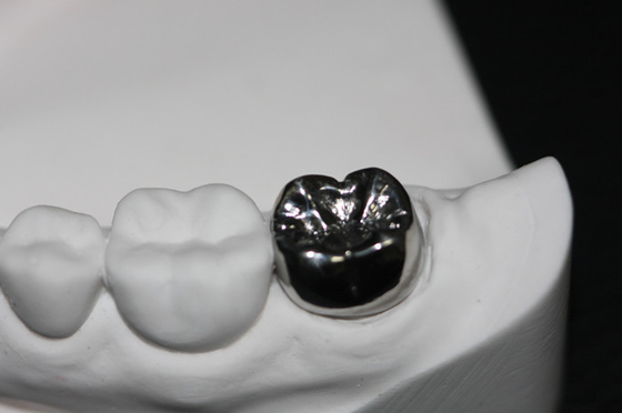 Ponte dental natural da coroa de FDA da estabilidade de cor resistente à corrosão