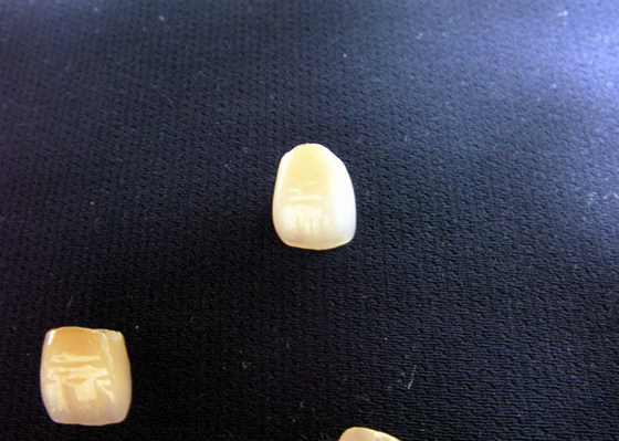 Estabilidade de cor fundida da coroa do metal do cosmético PFM porcelana forte