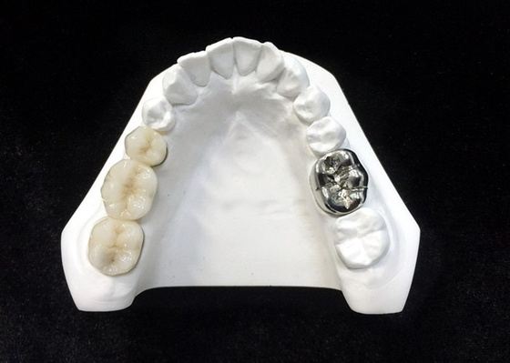 Alto densidade dental da segurança da saúde da coroa da porcelana ultra dura de Digitas