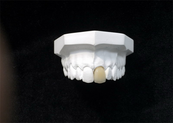 Elevação dental da coroa da boa porcelana de Biocompatibility - material biológico da tecnologia